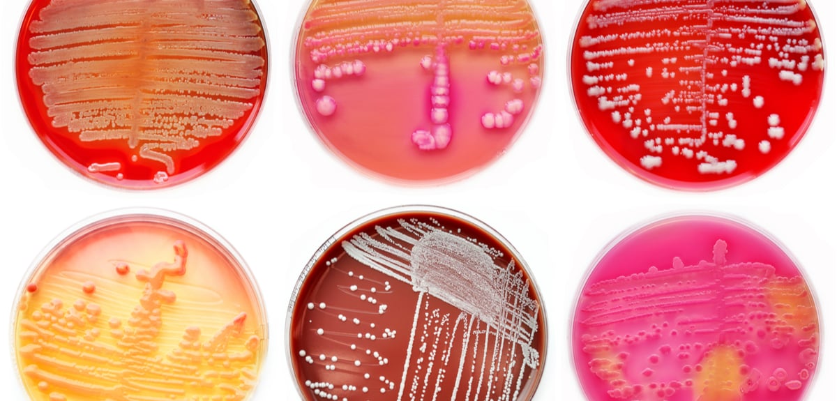 How can evolutionary biology help to get rid of antibiotic resistant bacteria? University of